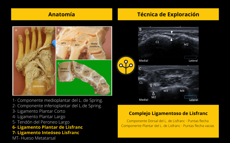 Complejo Ligamentoso de Lisfranc.png